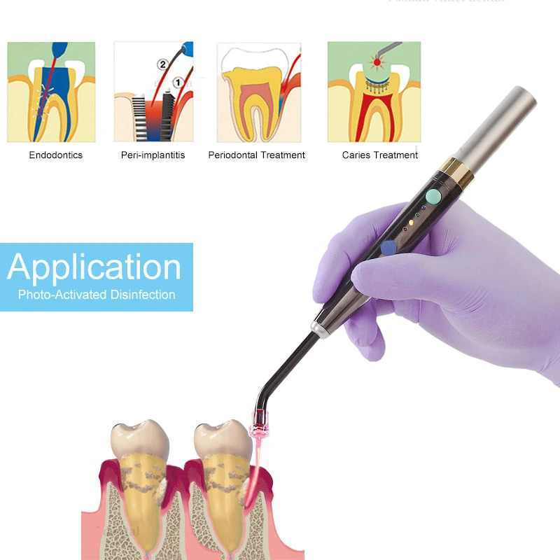 Sistema Láser Dental Inalámbri - Photography Lighting Equipment reseña y precio