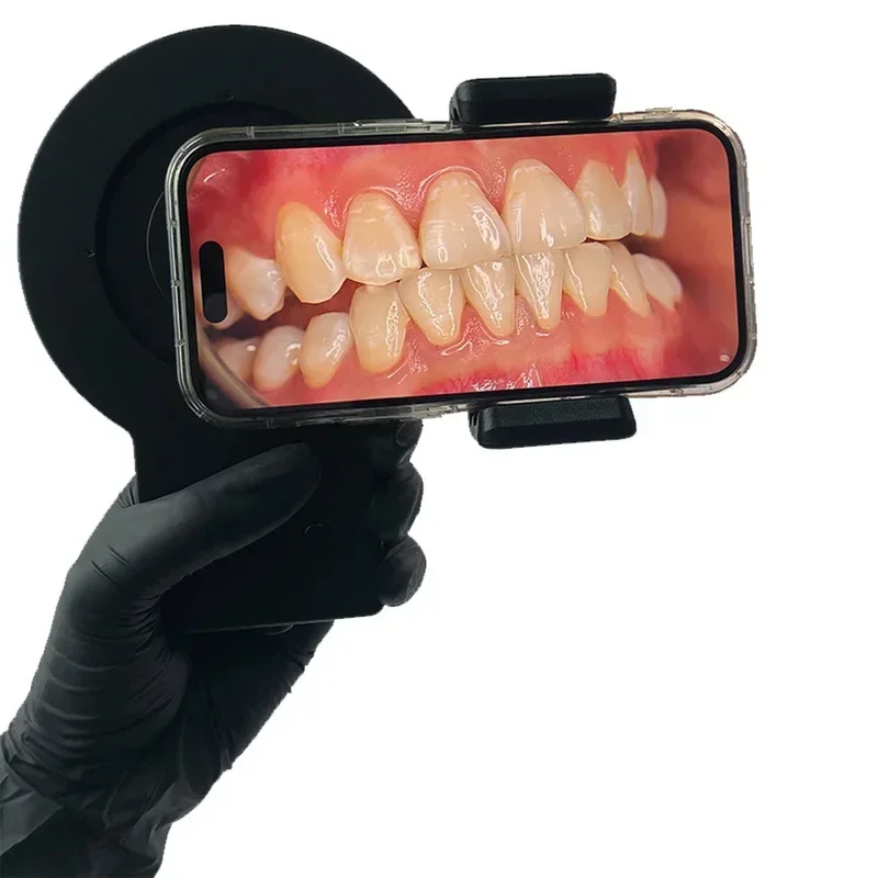 Equipo de fotografía dental Fu - Photography Lighting For Sale reseña y precio
