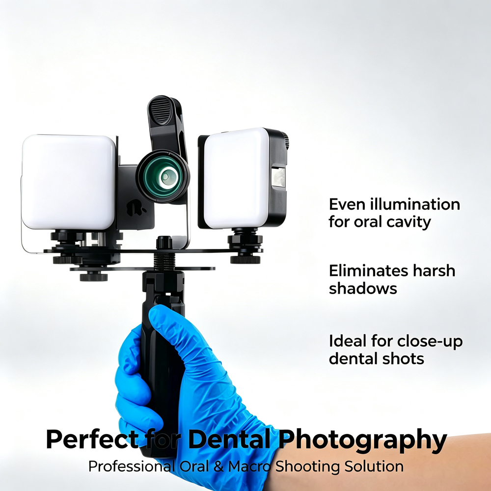 LODDEN Luz de relleno Dental c - Photography Lighting Equipment reseña y precio