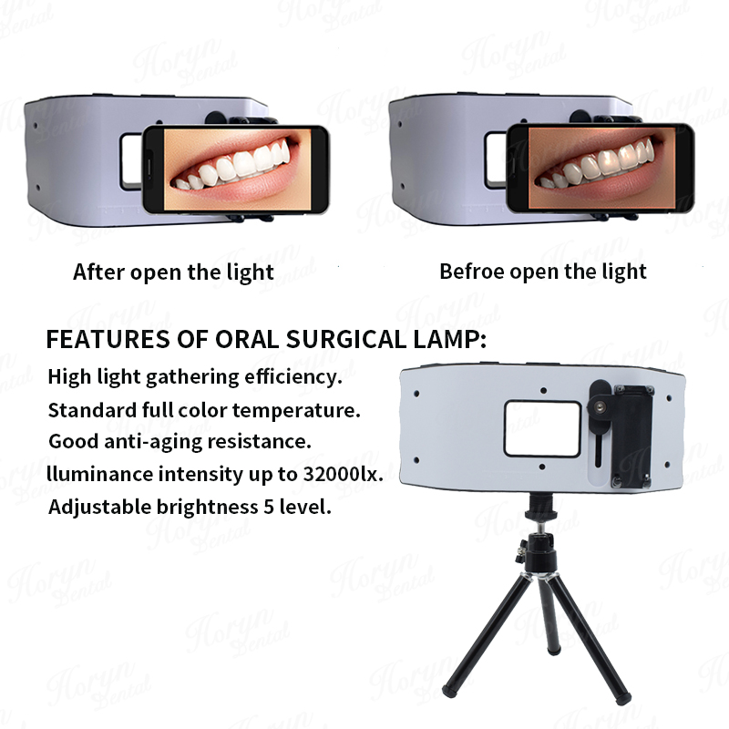Luz de Flash Dental, equipo de - Photography Lighting Equipment reseña y precio